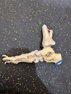 成長期に起こる踵の痛み 2 IMG 0212