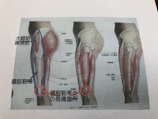 5C540CC5 C722 4CBC B853 904AB939337A