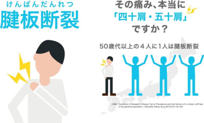 43161202 85CA 4072 B358 21EA180E1781